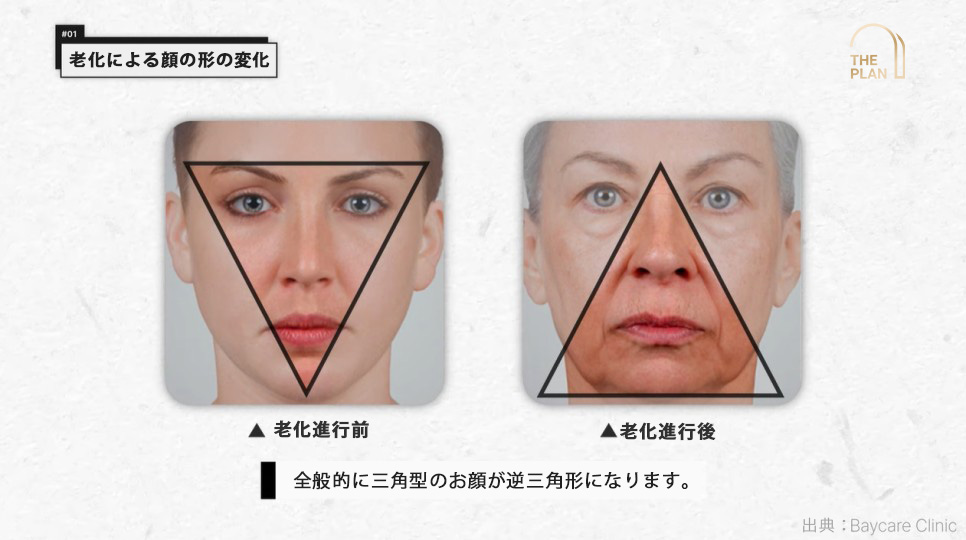老化進行による顔の形態変化